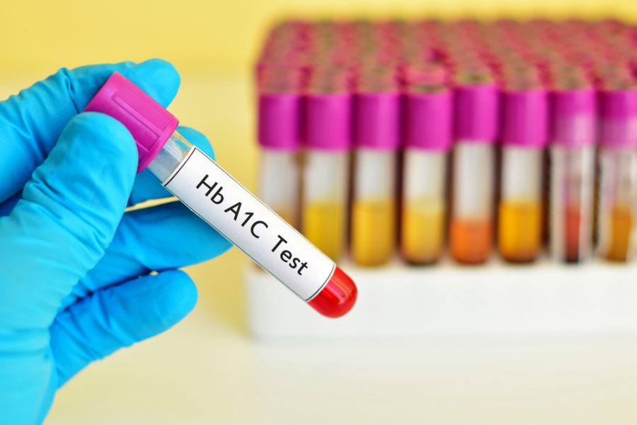 In diabetics, what does a1c stand for?